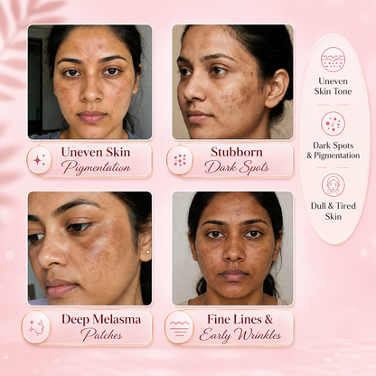 Magic Skin Face Serum for Hyper Pigmentation | Melasma | Dark Spots Removal