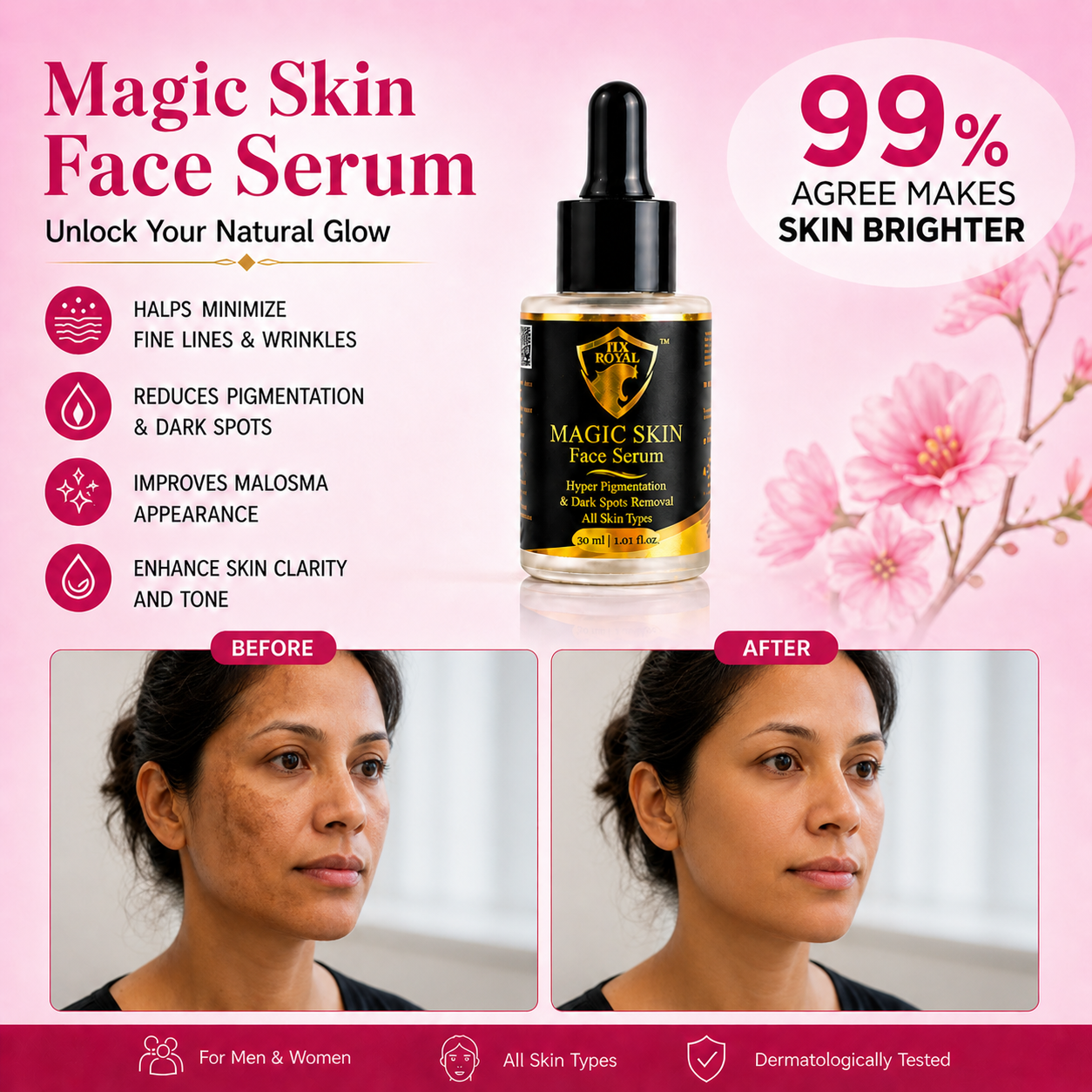 Magic Skin Face Serum for Hyper Pigmentation | Melasma | Dark Spots Removal