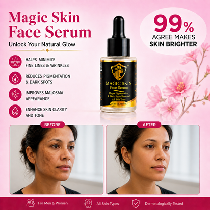 Magic Skin Face Serum for Hyper Pigmentation | Melasma | Dark Spots Removal