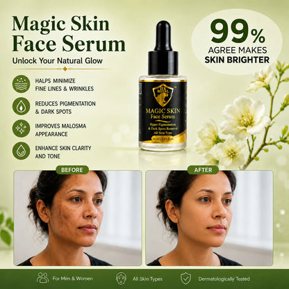 NX Royal Anti Acne Facewash & Magic Skin Serum Combo